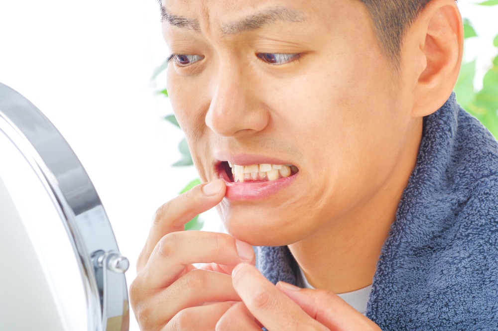 How to Take Care of Your Teeth After a Root Canal